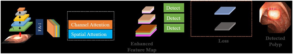 Feature aggregation, channel and spatial attention, multi-scale detection and an example detected polyp.